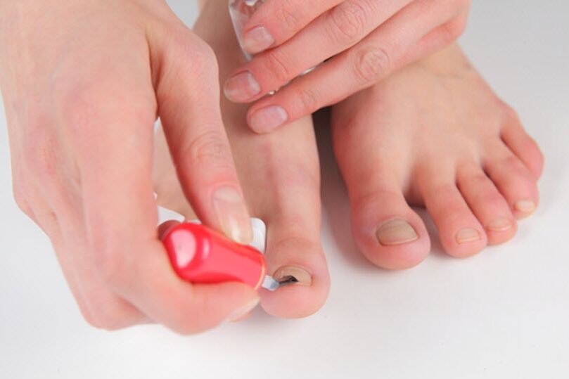 Foot fungus prevention